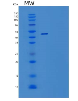 Recombinant Mouse IL-15 Receptor Subunit α/CD215/IL-15RA Protein(C-Fc)