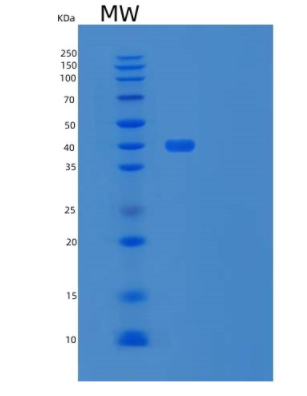 Recombinant Human BMP Receptor II/BMPR2/PPH1 Protein(C-Fc-6His)