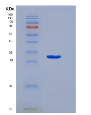 Recombinant Nerve Growth Factor (NGF)