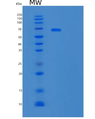 Recombinant Mouse Tyrosine-Protein Kinase Receptor TYRO3/Dtk Protein(C-mFc)