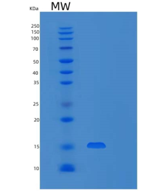 Recombinant Human Fibroblast Growth Factor 1/FGF-1/FGFa(Phe16-Asp155) Protein