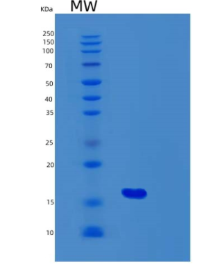 Recombinant Human Fibroblast Growth Factor 2/FGF-2/FGFb(Gly132-Ser288) Protein