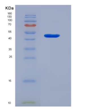 Eukaryotic Cluster Of Differentiation 14 (CD14)