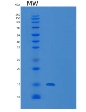 Recombinant Human CD160/BY55 Protein(C-6His)