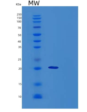 Recombinant Mouse Sonic Hedgehog Protein (His Tag)