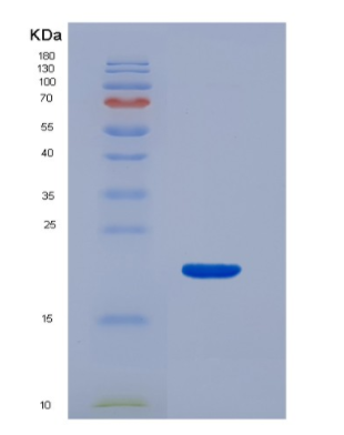 Eukaryotic Interferon Gamma (IFNg).