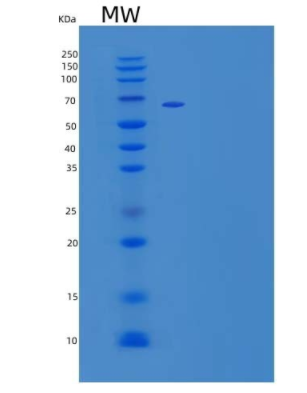 Recombinant Mouse Nogo-66 Receptor/Reticulon 4 Receptor/NgR/RTN4R Protein(C-Fc)