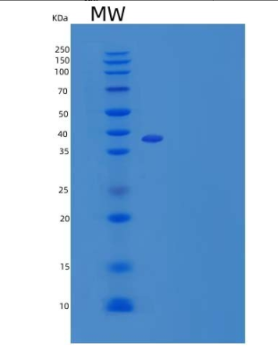 Recombinant Mouse Nephroblastoma Overexpressed Gene /NOV/CCN3/IGFBP-9 Protein(C-6His)