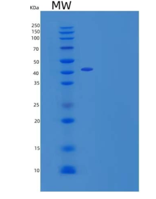 Recombinant Mouse Nogo-66 Receptor/Reticulon 4 Receptor/NgR/RTN4R Protein(C-6His)