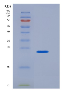 Recombinant Human CD16a / FCGR3A Protein (176 Phe, His tag)