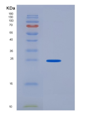 Recombinant Human CD16a / FCGR3A Protein (176 Val, His & AVI tag)