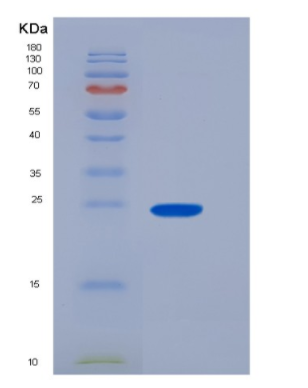 Recombinant Human CD16a / FCGR3A Protein (176 Val, His & AVI tag), Biotinylated