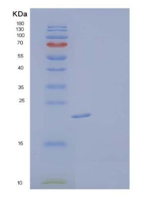 Recombinant Human PRL Protein