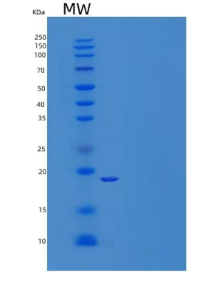 Recombinant Rat Stem Cell Factor/SCF Protein(C-6His)