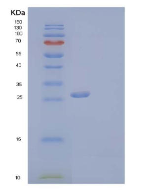 Recombinant Human Collectin-11/COLEC11 Protein(C-6His)