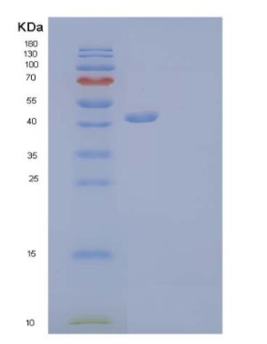 Recombinant Mouse GITR/TNFRSF18/CD357 Protein(C-Fc-6His)