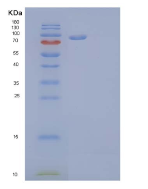 Recombinant Human Oncostatin-M-Specific Receptor Subunit β/OSMRB/IL-31RB Protein(C-6His)