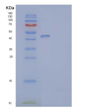 Recombinant Human T-lymphocyte Surface Antigen Ly-9/SLAMF3/CD229 Protein(C-6His)