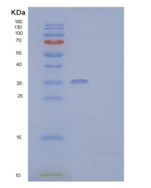 Recombinant Human Granulocyte-Macrophage Colony-Stimulating Factor Receptor Subunit alhpa Protein