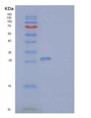 Recombinant Human IL-2 Receptor Subunit γ/IL-2RG/CD132 Protein(C-Fc-6His)