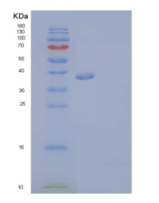Recombinant Human Fibroblast Growth Factor Receptor 3 Protein