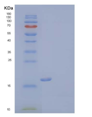 Recombinant Human Triggering Receptor Expressed On Myeloid 2/TREM-2 Protein(C-6His)