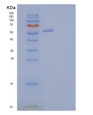 Recombinant Human Ephrin type-A receptor 4 Protein