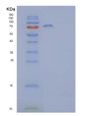 Recombinant Human Ephrin type-B receptor 2 Protein