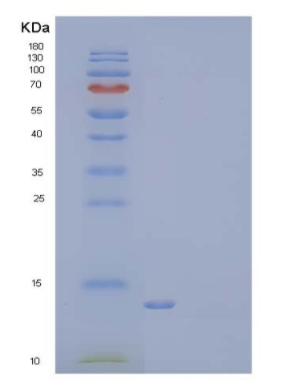 Recombinant Mouse LAIR1 Protein(C-6His)