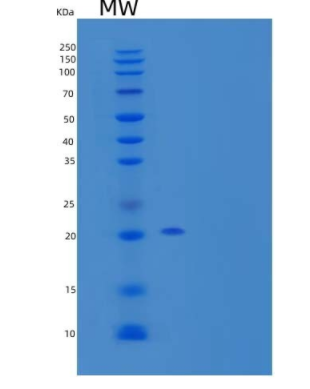 Recombinant Human Fibroblast Growth Factor 21/FGF-21 Protein(N-6His)