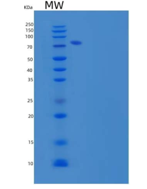 Recombinant Human Semaphorin 3C/SEMA3C Protein(C-6His)