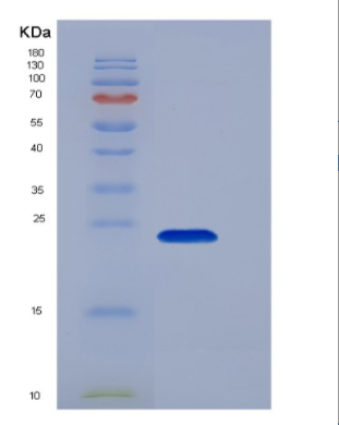 Recombinant Human CD16a / FCGR3A Protein (176 Val, His tag)