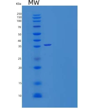 Recombinant Human Galectin 9 Protein(C-6His)