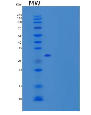 Recombinant Human MMP-3 Protein