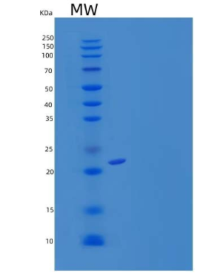 Recombinant Human UBE2F Protein (His tag)