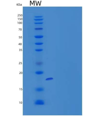 Recombinant Human CALML3 Protein (His tag)