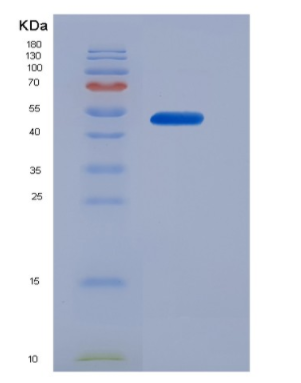 Recombinant Human CD16b / FCGR3B Protein