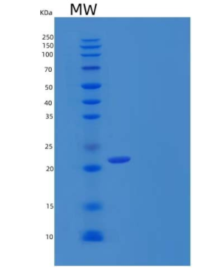 Recombinant Human Stem Cell Factor/SCF/c-Kit Ligand Protein(C-6His)