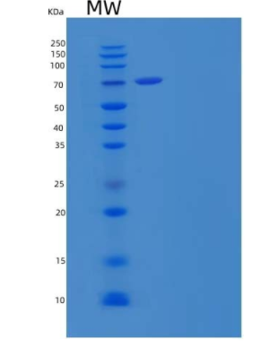 Eukaryotic Carcinoembryonic Antigen (CEA)