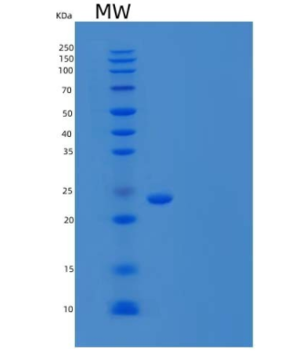 Recombinant Human NKG2D Ligand 1/NKG2DL/ULBP1 Protein(C-6His)