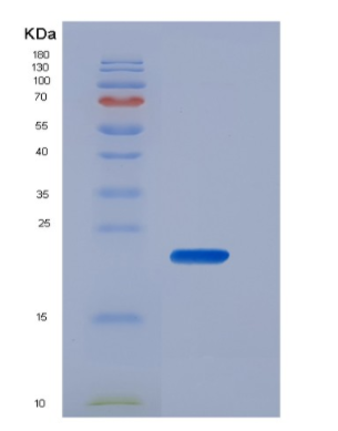 Recombinant Human CD16b / FCGR3B Protein (His tag)