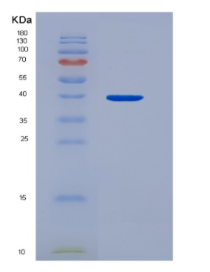 Recombinant Hepatoma Derived Growth Factor (HDGF)