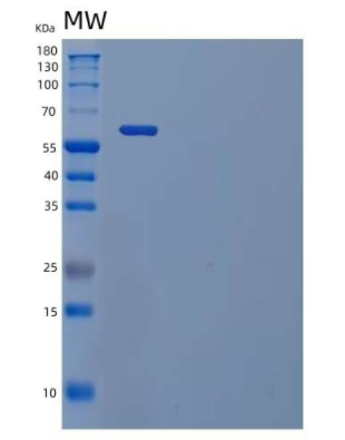 Recombinant Human IL-1 Receptor Type 1/IL-1R-1 Protein(C-Fc)