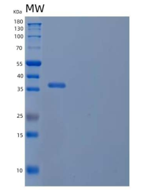 Recombinant Mouse CD5 antigen-like Protein.