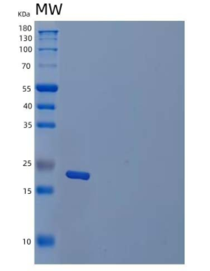 Recombinant Human Transcobalamin II Receptor/TCblR/8D6A/CD320 Protein(C-6His)