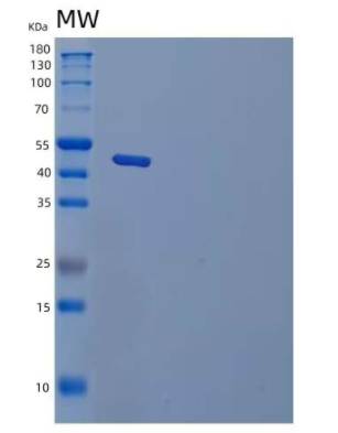 Recombinant Human Transcobalamin II Receptor/TCblR/8D6A/CD320 Protein(C-Fc)