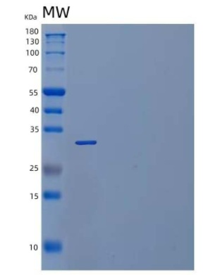 Recombinant Human Follistatin-like Protein 1 Protein