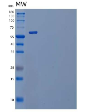 Recombinant Mouse IL-1 Receptor-Like 1/IL-1RL1/IL-1 R4 Protein(C-Fc)