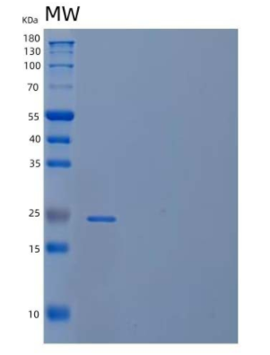 Recombinant Human Coiled-Coil Domain-Containing Protein 134/CCDC134 Protein(C-6His)