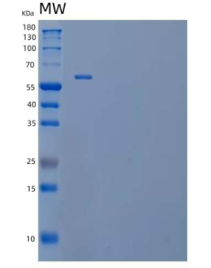 Recombinant Human Complement Factor H-related 5/CFHR5 Protein(C-6His)